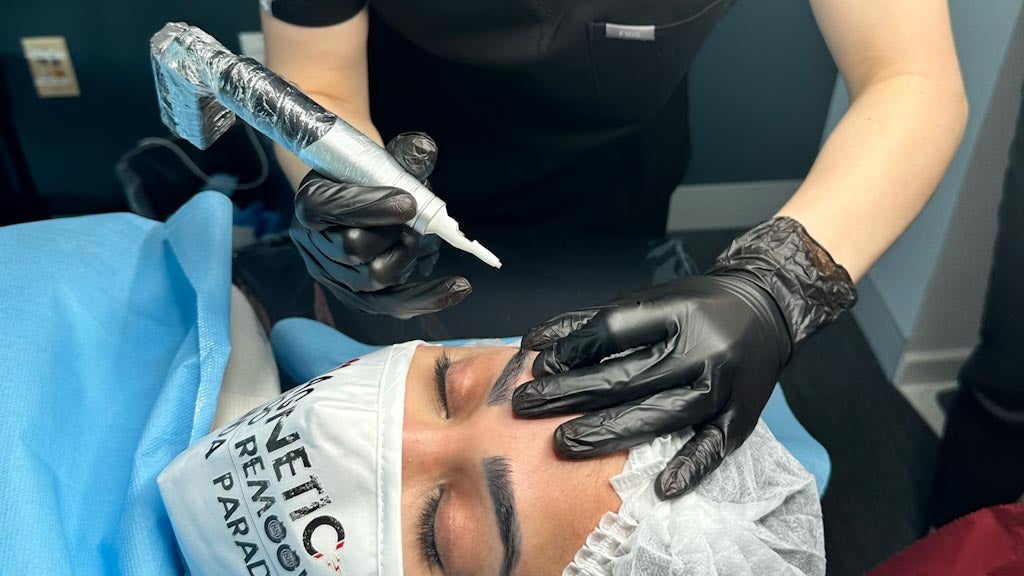 So many things that can go wrong' - tattoo removal in NZ | The Press